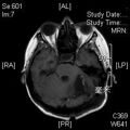 MRI послеоперационный (11)